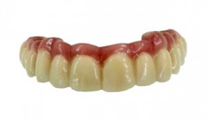 prótesis dentales sobredentadura
